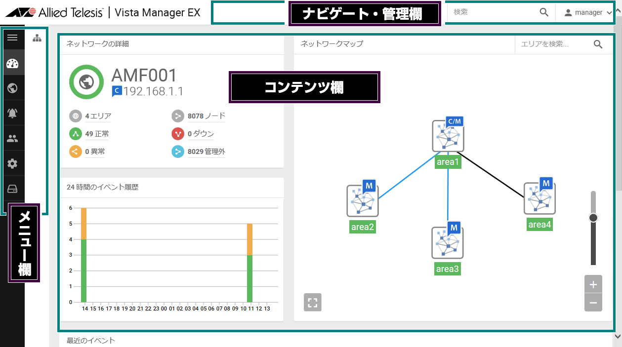 AVM EX